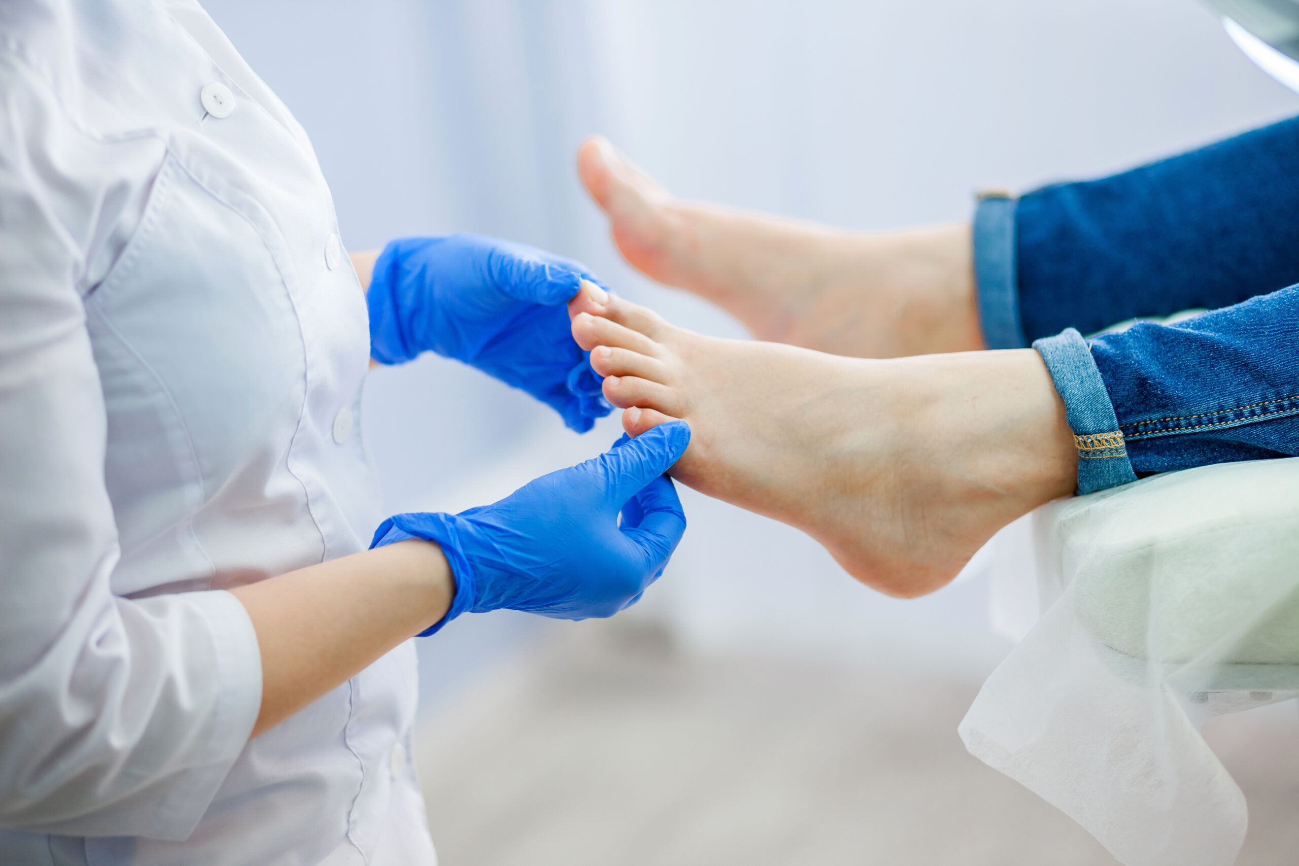 Cosa sappiamo dell’ Onicomicosi? Prevenzioni e rimedi per l’infezione fungina delle unghie Cosa sappiamo dell’ Onicomicosi? Prevenzioni e rimedi per l’infezione fungina delle unghie