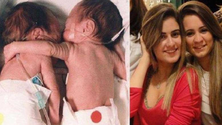 Il “Co Bedding” nei neonati prematuri: Il caso delle gemelle Brielle e Kyrie Jackson come catalizzatore scientifico. Il “Co Bedding” nei neonati prematuri: Il caso delle gemelle Brielle e Kyrie Jackson come catalizzatore scientifico.